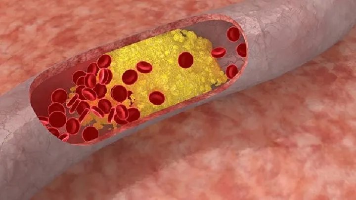 西医治疗西尼罗河病毒感染的常规方法