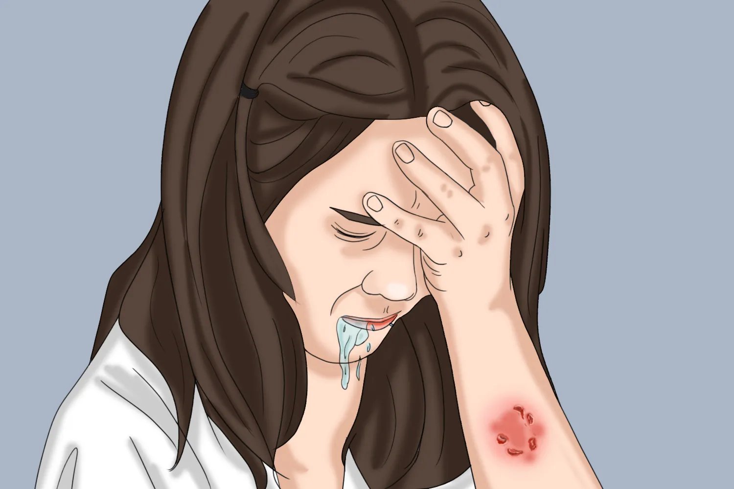 人得了狂犬病有什么症状图片