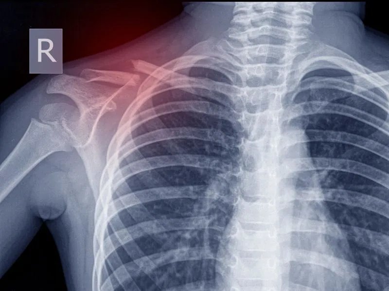 核辐射症状表现