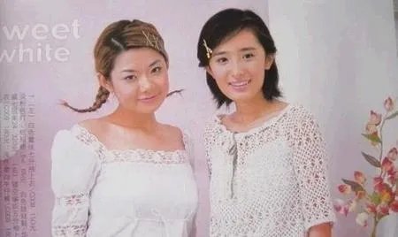 杨幂整容了吗？