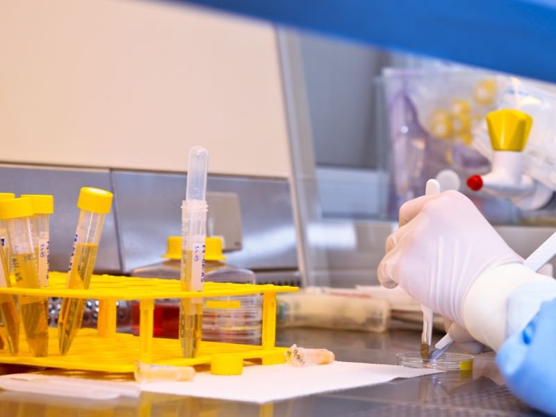 肝功能检查的各项指标