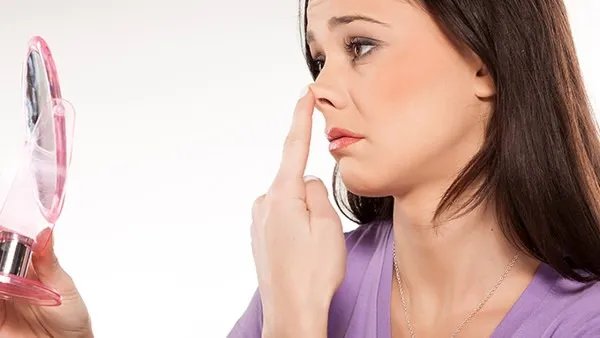 鼻子上毛孔粗大怎么办