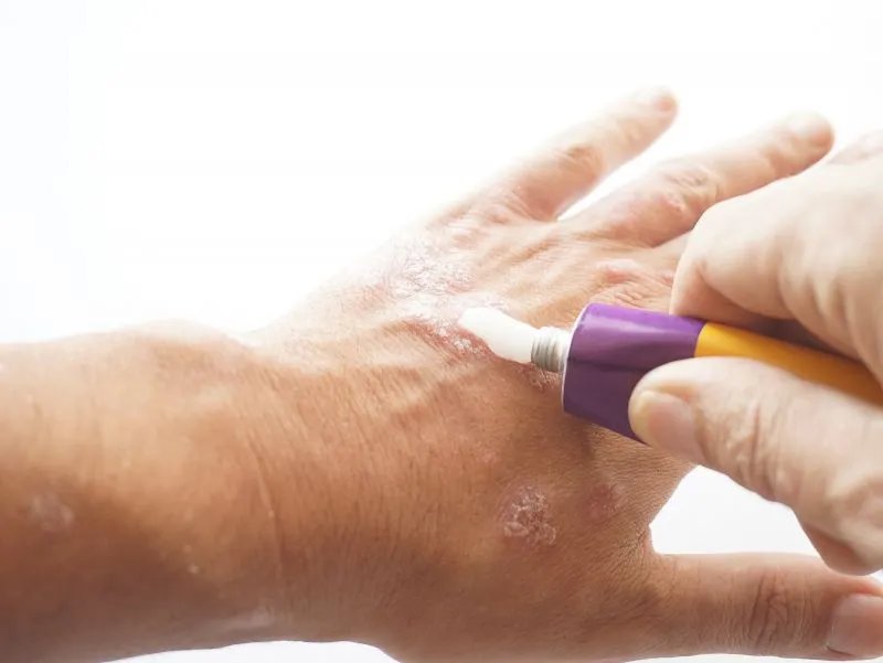 仙草活骨膏的作用与功效