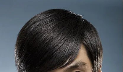 头发移植需要多少钱