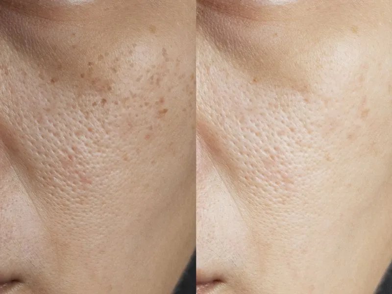 吃什么食物可以美容