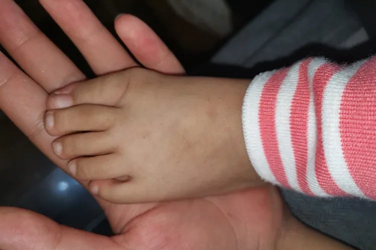 小孩大脚骨图片