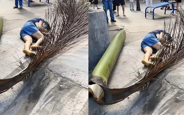 路人被椰子树叶砸倒颅内积血 目前情况怎么样