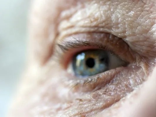 下眼皮皱纹出现的原因是什么