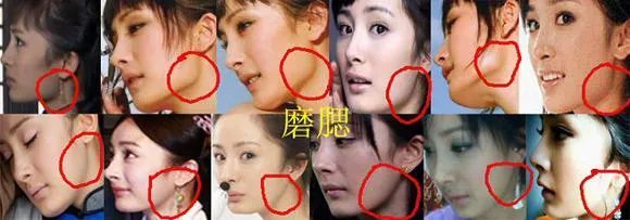 杨幂整容了吗？