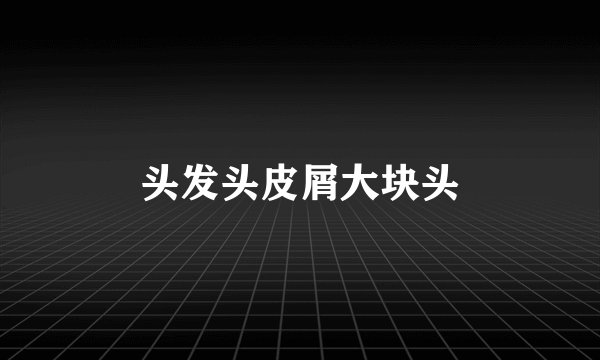 头发头皮屑大块头