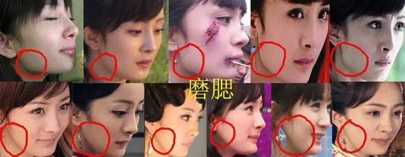 杨幂整容了吗？