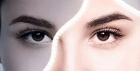 激光祛斑到底怎么样