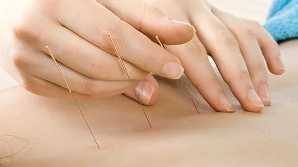 针刺放血后的注意事项