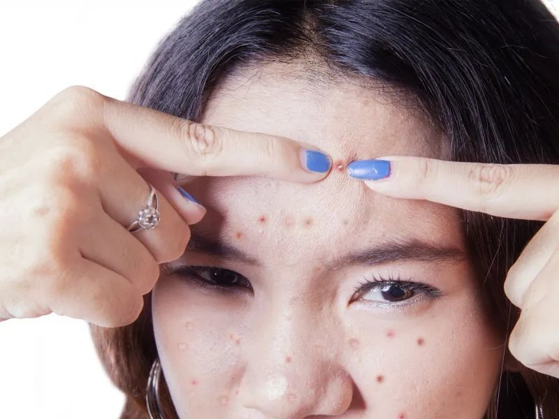 醋美容护肤小窍门