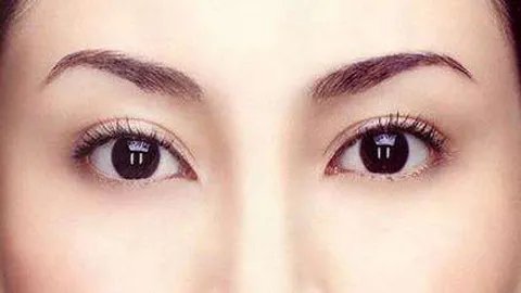 切眉除皱术怎么做