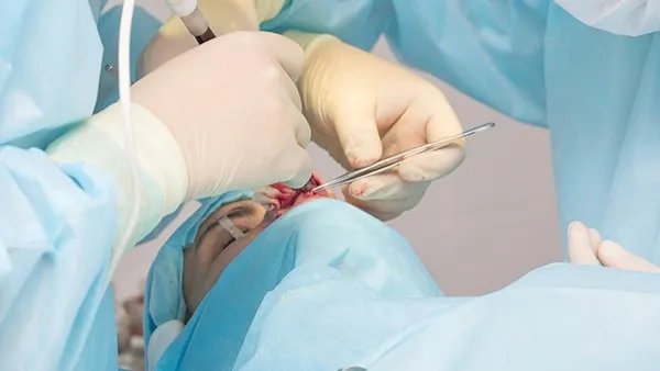 假体隆鼻手术怎么做