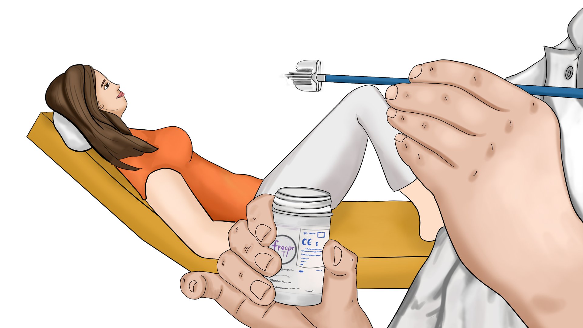 子宫颈细胞学检查