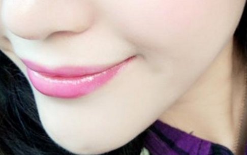 玻尿酸注射丰唇有什么优势