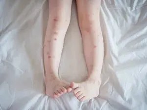 腿向上靠墙式能瘦腿吗 腿向上靠墙式有什么好处