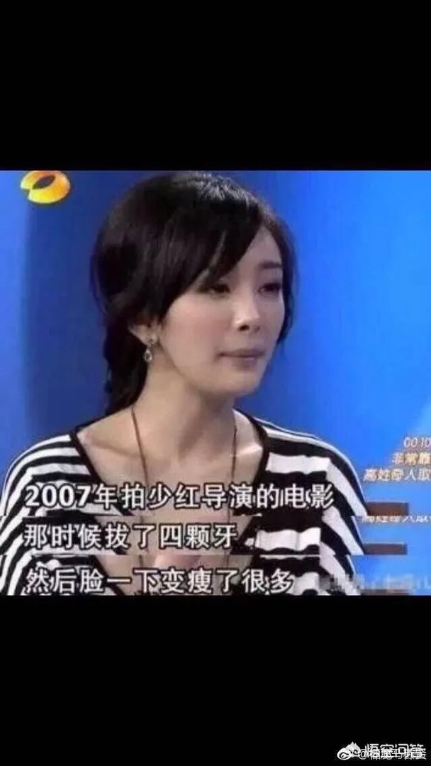 杨幂整容了吗？