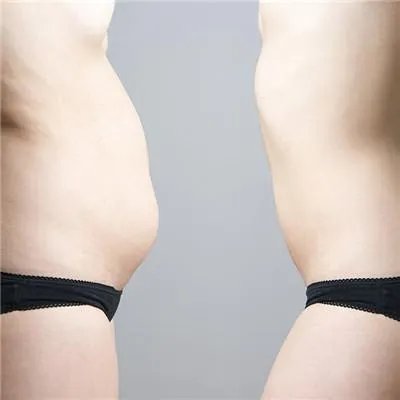 怎么才能健康减肥