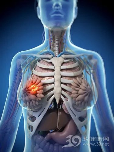 乳房保健操 让你的乳房不再“生病”