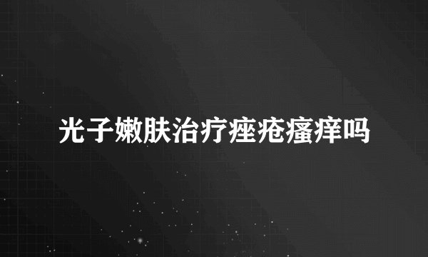 光子嫩肤治疗痤疮瘙痒吗