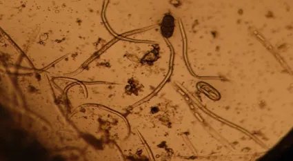 在自然界的生物中，目前关于恶魔线虫有怎样的研究？