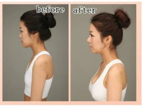 整容费用大概多少