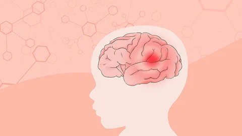 心脑血管硬化是什么原因引起的