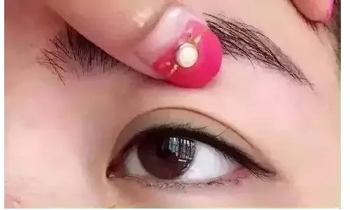 北京双眼皮一般多少钱