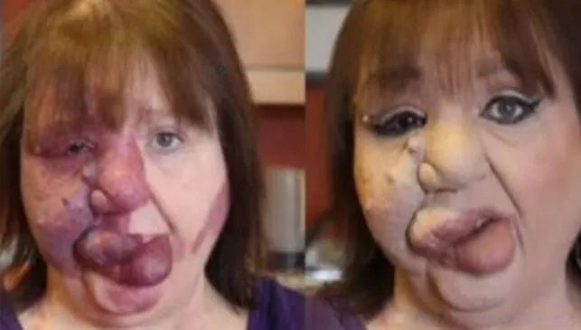 最丑的女人图片吓人 世界上最丑的人第一名