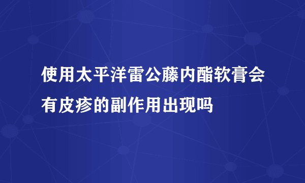 使用太平洋雷公藤内酯软膏会有皮疹的副作用出现吗