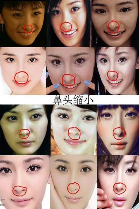 杨幂整容了吗？