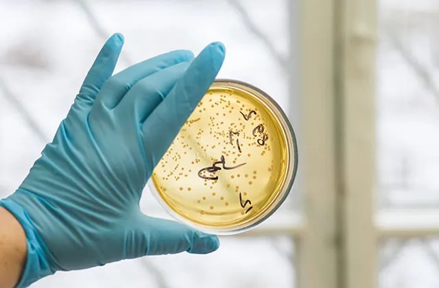 培养基配制方法和注意事项 培养基的配制原则有哪些