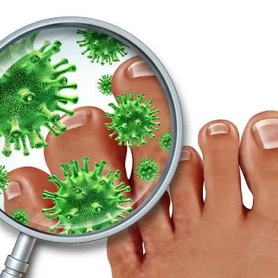 夏天脚底脱皮是怎么回事