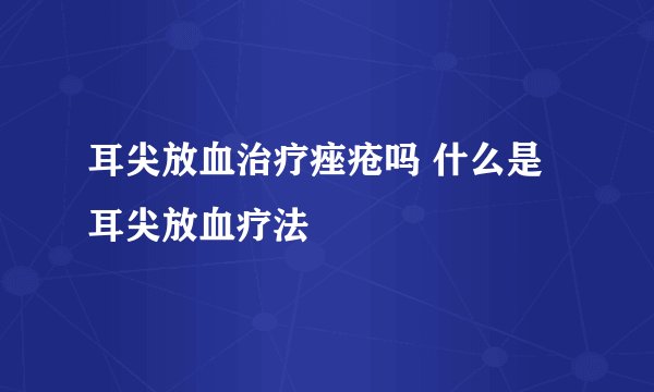 耳尖放血治疗痤疮吗 什么是耳尖放血疗法
