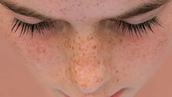 怎么祛斑,快速祛斑的方法