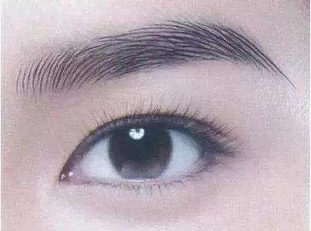 眼袋抽脂要注意什么