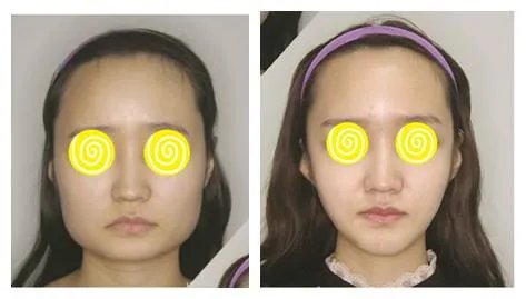 2021北京联合丽格第一医疗美容医院下颌角价格表(价目表)怎么样?