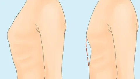 双侧肋膈角锐利主要原因有哪些