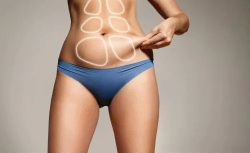 做吸脂手术要多少钱