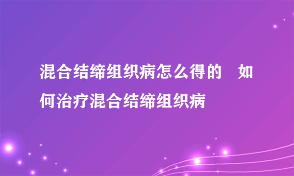 混合结缔组织病怎么得的 如何治疗混合结缔组织病