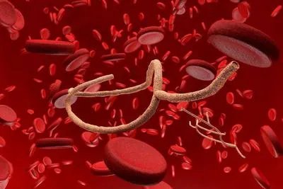 出血热症状有哪些 出血热的四个症状详述