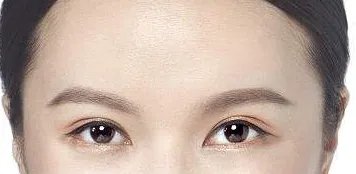 激光洗眉一般多少钱