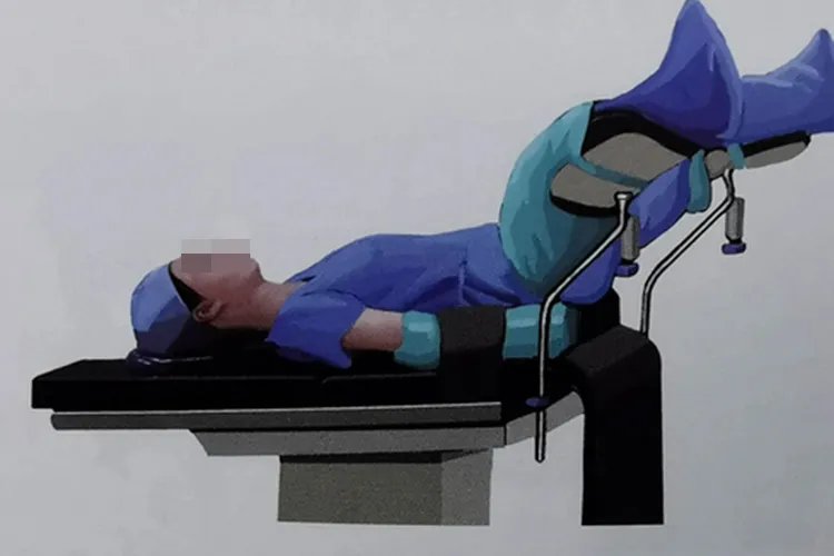 刮宫手术怎么做图解