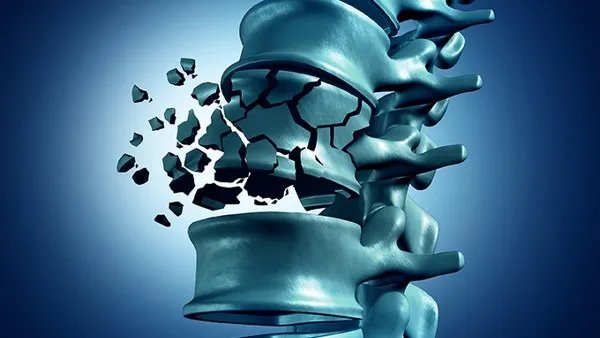 椎体压缩骨折怎么办