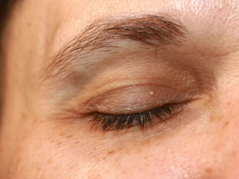 怎样预防眼部皱纹