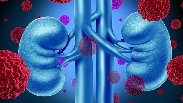 肾虚的症状有哪些?