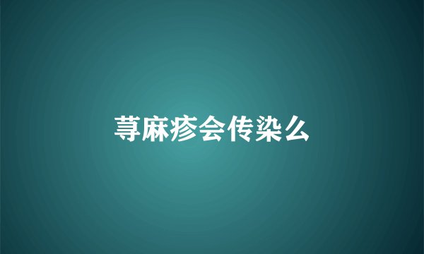 荨麻疹会传染么